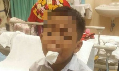 Boy Force To Cut Off Own Tongue By Bullies