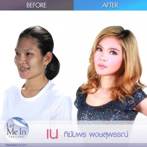 Amazing Plastic Surgery, Thai Girls Transform