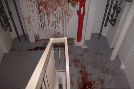 Slashing incident at HDB …knife fight