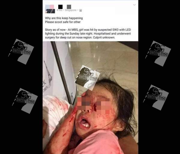 Another F*king E-Scooter Rider Accident, Small Girl Requires Facial Surgery