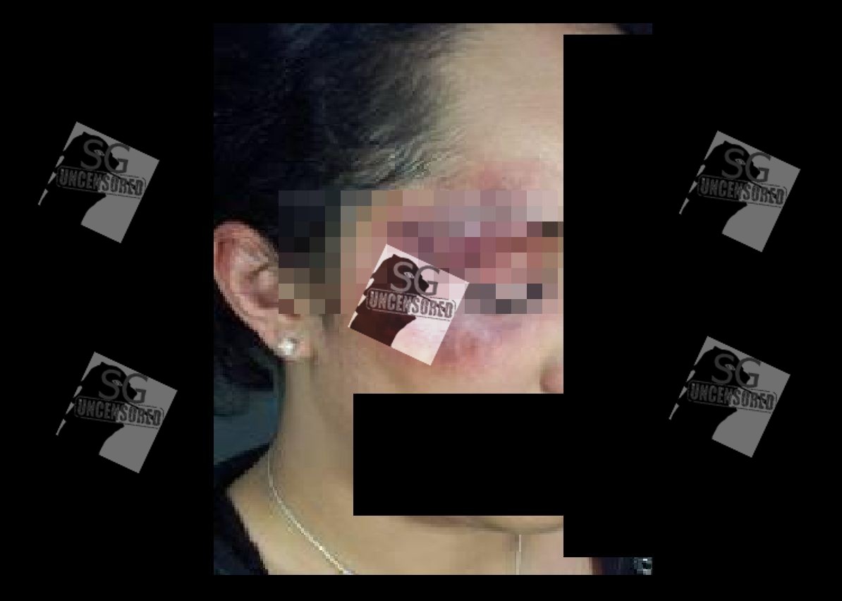 “My Drunk Husband Beats Me Up After Drinking”