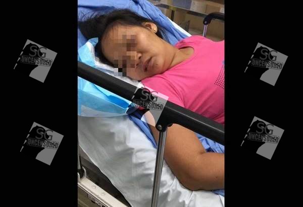 Takashimaya escalator faulty cause woman fractures her neck, unable to talk and response