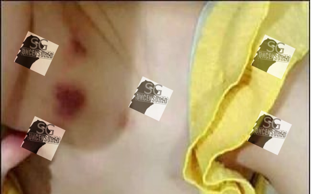 Got Drunk at new year party “Tell Bf give love bite but blame him for doing it”