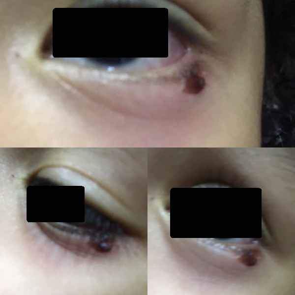 KID INJURED @ PCF SPARKTOTS AYER RAJAH. IRRESPONSIBLE BY SAYING THEY CANT WATCH ALL KIDS