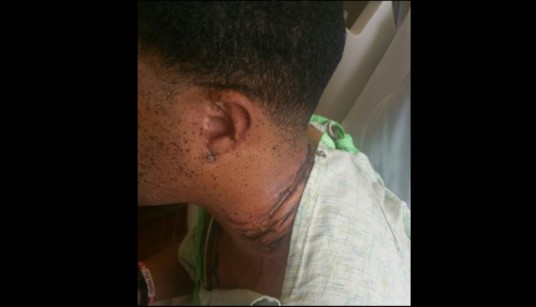 MAN WHO CHARGE HIS SMARTPHONE OVERNIGHT GET ELECTROCUTED BY IT!!