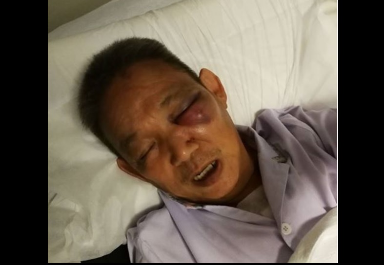 “E SCOOTER RIDER ASSAULT MY FATHER AT PAYA LEBAR!!” TRIGGERED HEART ATTACK!!