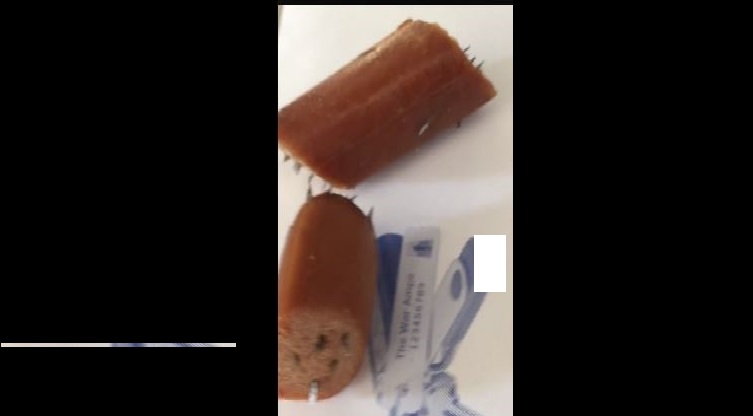 CANADA DOG OWNER FOUND RAZOR FILL HOTDOGS IN HER YARD!!