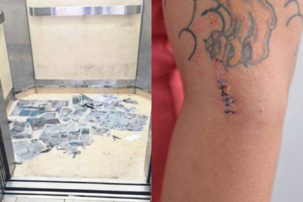 EX-BF GETS STABBED BY PREGNANT WOMAN AFTER HE BREAKS UP WITH HER!!