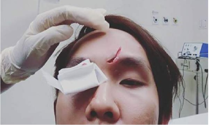 APPEALING FOR WITNESS – INCIDENT AT GEYLANG BAZZAR