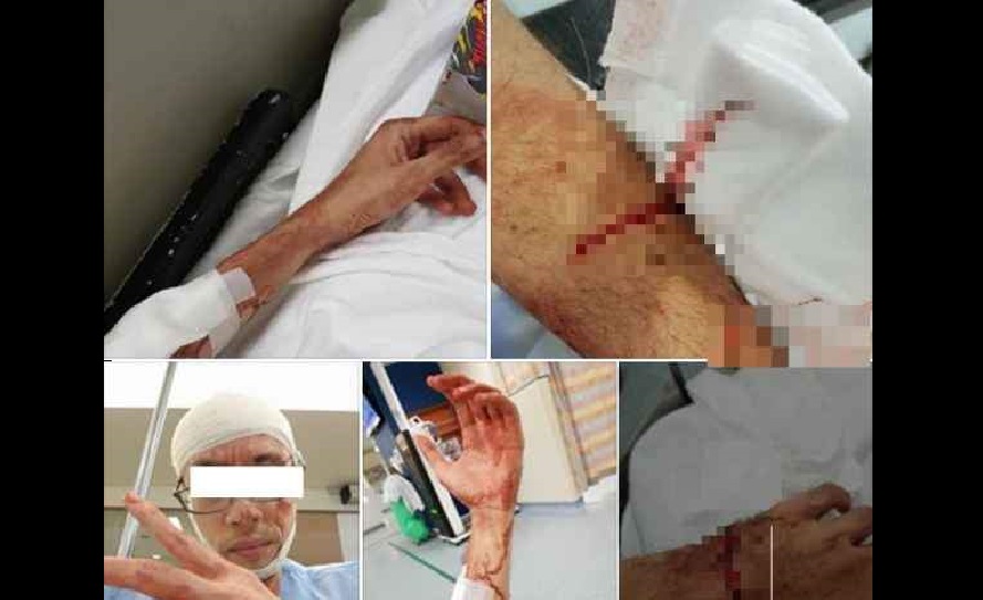 SG GUY GOT SLASHED BY UNKNOWN ATTACKER! SEND TO CGH