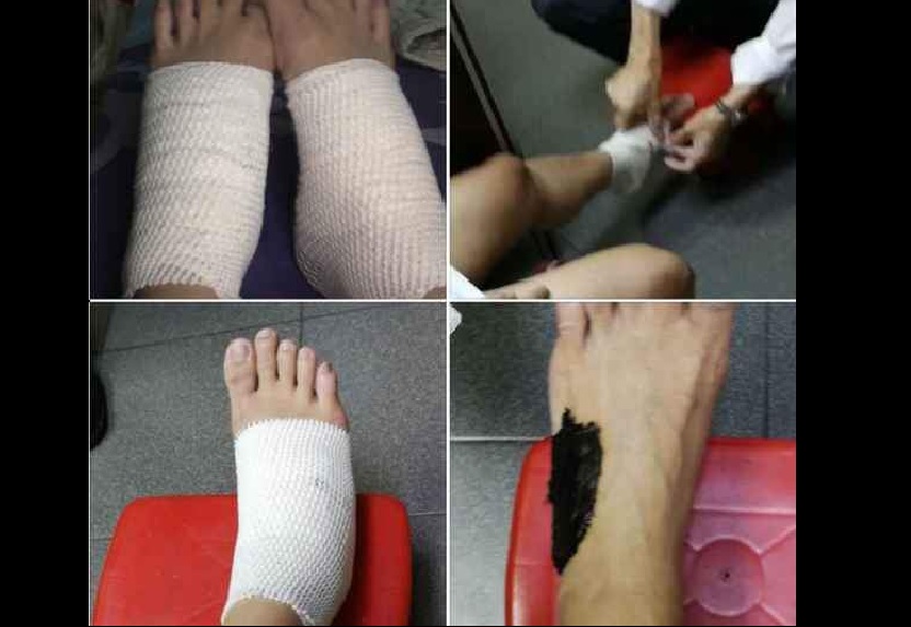 AFTER GETTING HIT BY CAR. DRIVER SPED OFF.