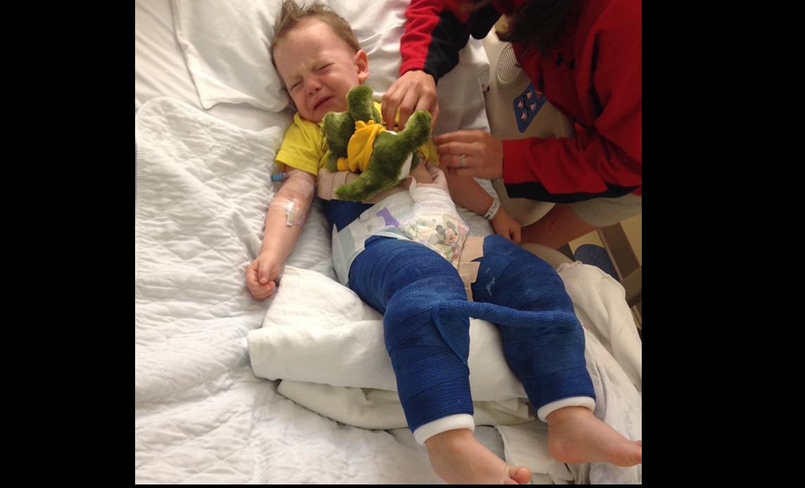 PARENTS TAKE NOTE: THIS IS WHY YOU SHOULDN’T LET YOUR CHILD UNDER 6 USE A TRAMPOLINE!!