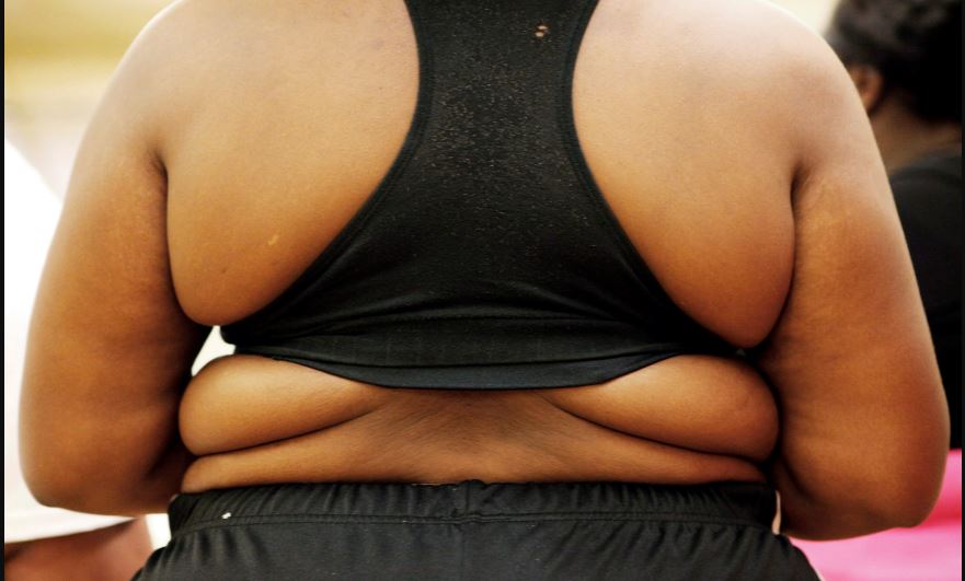 OVERWEIGHT FEMALE LOOKING TO LOSE SOME WEIGHT BUT AFRAID SHE WILL GET COVER IN LOOSE SKIN