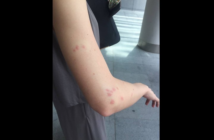 NETIZEN BITE BY BUGS ON SCOOT PLANE!!! NOT FIRST TIME…