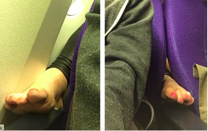 PASSENGER FROM MANILA TO SG. POKE FOOT THROUGH SEATS TO LET PEOPLE SMELL
