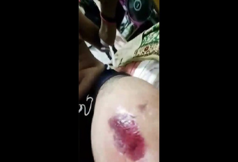 MAN KNOCKED DOWN BY HIT & RUN CASE @ TOA PAYOH. SEEKING WITNESS (VIDEO)