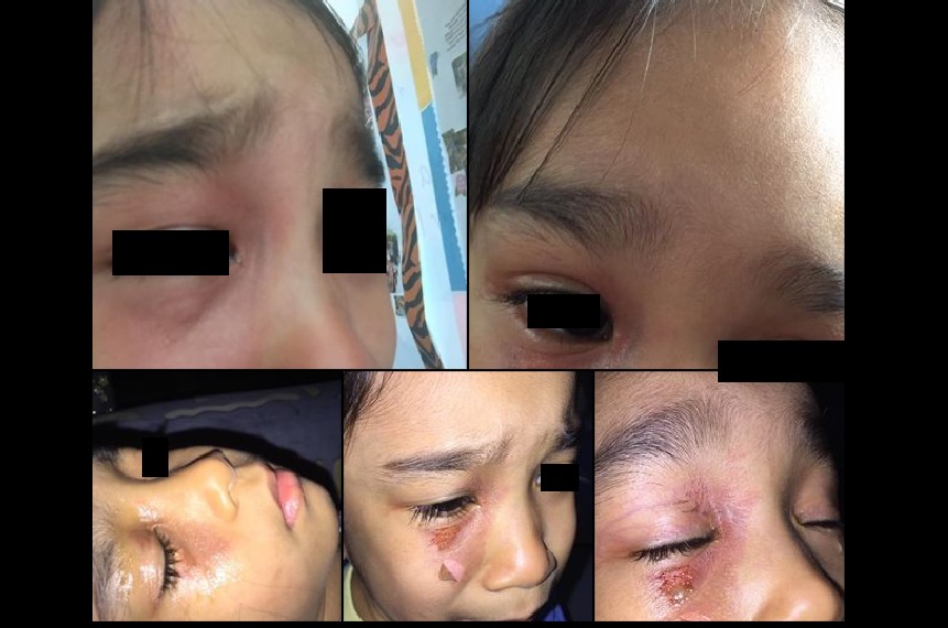 CHILDCARE PLACE BOILING WATER IN REACH OF CHILDREN. NOW CHILDCARE WANT SUE FOR DEFAMATION