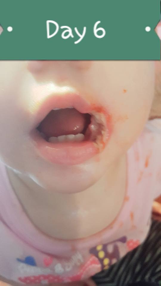 Please beware, Don’t let kid put charger in mouth.