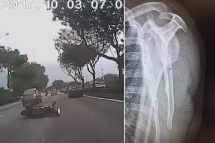 MY DAD WAS KNOCKED DOWN BY A DRIVER DELIBERATELY! PLEASE HELP SHARE! (VIDEO)