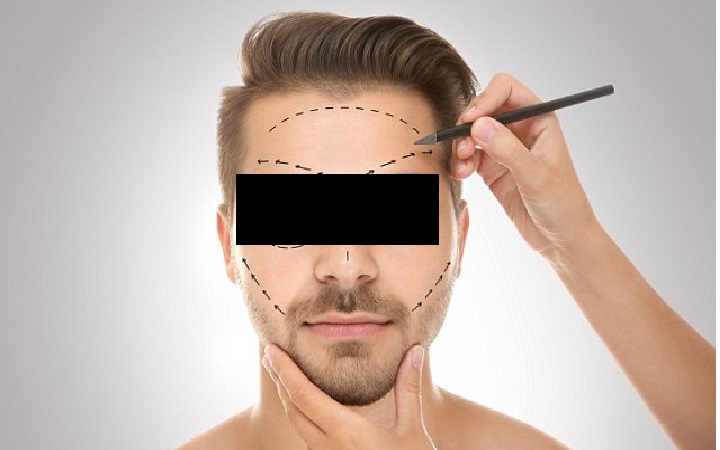 I NOT GOOD LOOKING AND BEING IN ENGINEERING COURSE MAKE ME LOOK WORSE! PLASTIC SURGERY?