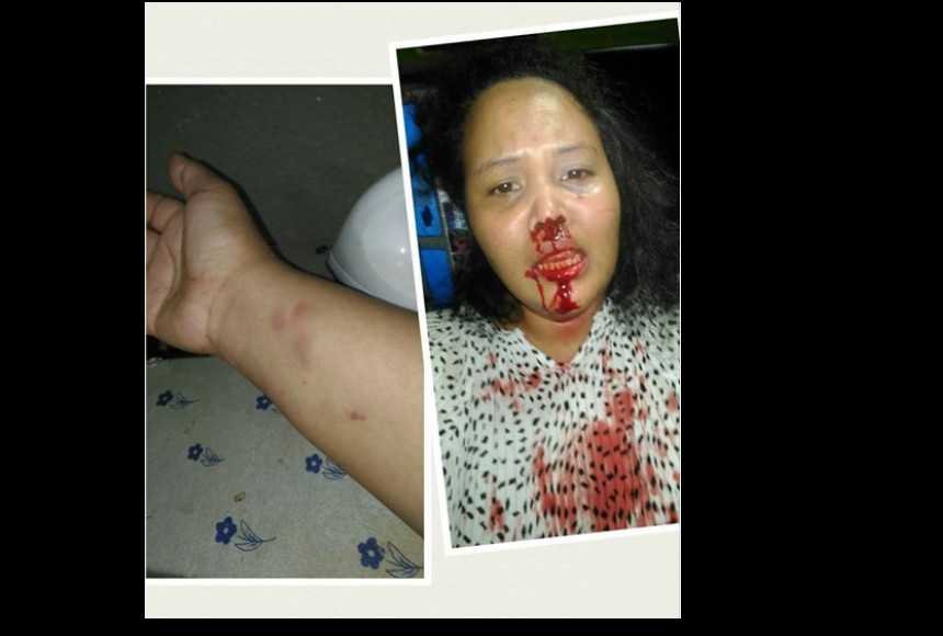 WOMAN BEATEN UP BY GUY THAT STAYS AT HER HOUSE