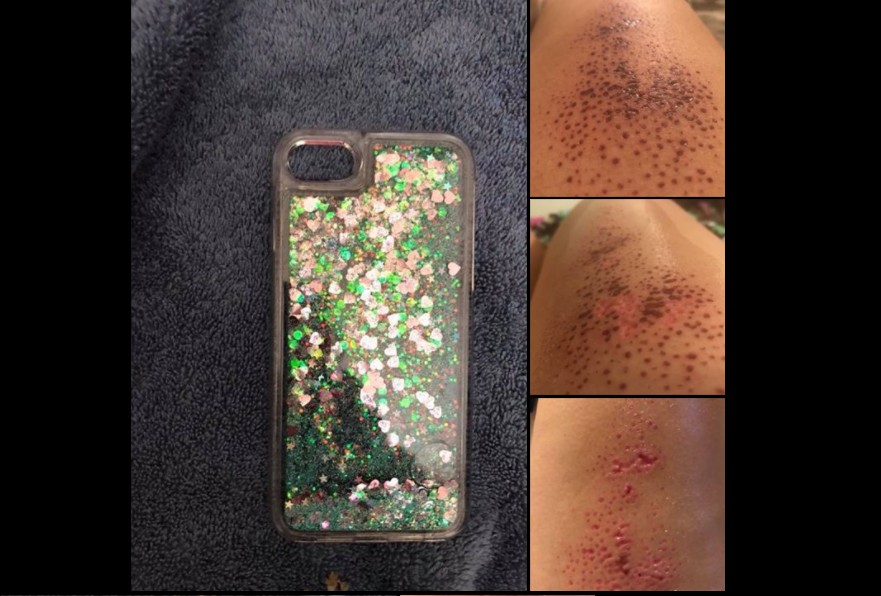 TAKE NOTE TO BE EXTRA CARE IF YOU HAVE THE PHONE CASE WITH GLITTERY AND LIQUID IN IT! TAKE NOTE TO BE EXTRA CARE IF YOU HAVE THE PHONE CASE WITH GLITTERY AND LIQUID IN IT!