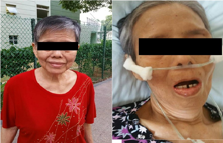 NURSE SCREWS UP AND CAUSE MOM TO DIE A PAINFUL DEATH