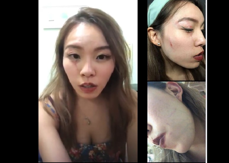 LOCAL GIRL GET BEAT UP IN A CLUB FOR NO REASON!