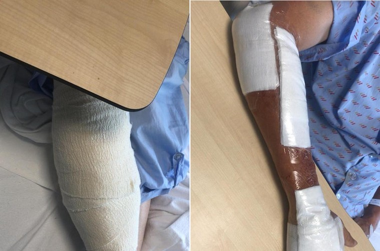 SEEKING WITNESS OR VIDEOS. MOTORCYCLE ACCIDENT TPE TO PIE