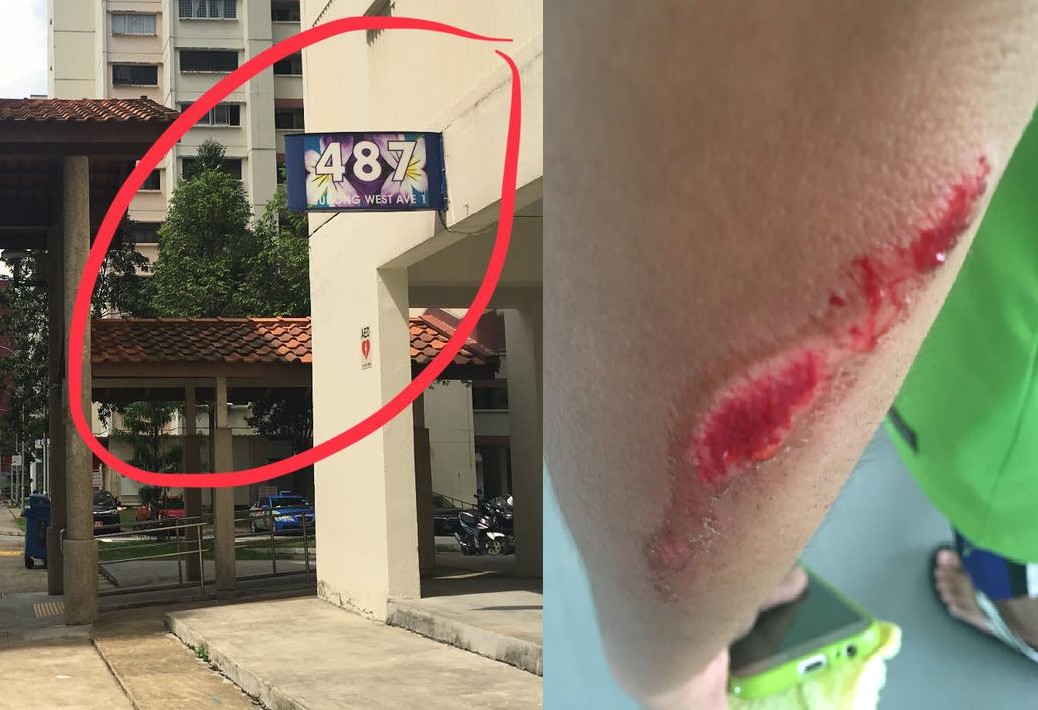 BLOODY E-SCOOTER HIT MY SON AND WENT OFF!!