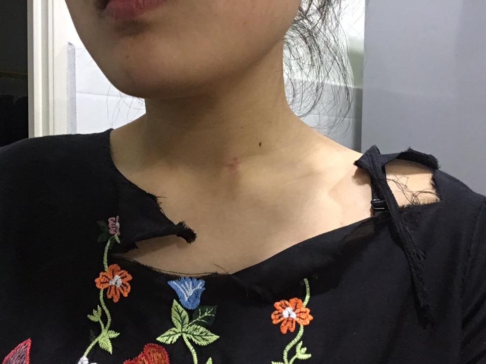 M’SIA MOTOR GANG ROBS WOMAN. CLOTHES TORNED!