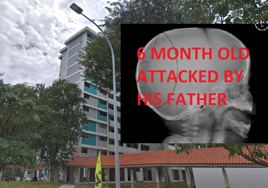 30 Y.O FATHER HIT 6 MONTH BABY TILL SKULL FRACTURE @ BEDOK