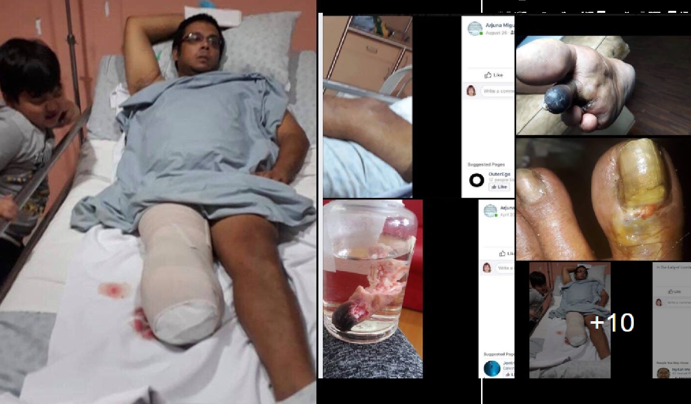 MAN LEGS AMPUTATED, HAVE 2 SMALL KIDS THAT NEED HELP!