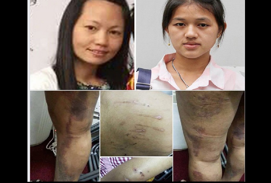 DOMESTIC HELPER ASSAULTED BY EMPLOYER WITH METAL POLE