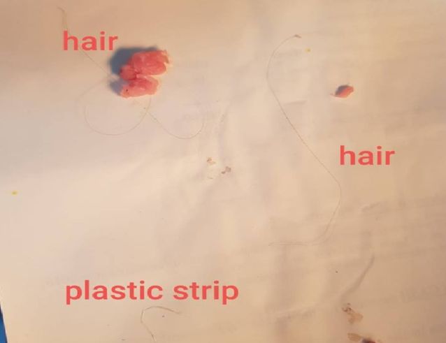 WOMAN FINDS HAIR AND PLASTIC STRIP FROM NTUC MINCED MEAT