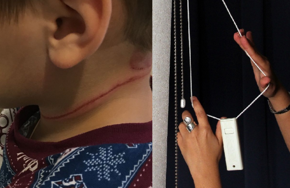 MOTHER WARNS OF BLINDS CORD AFTER SON NEARLY LOSES HIS LIFE