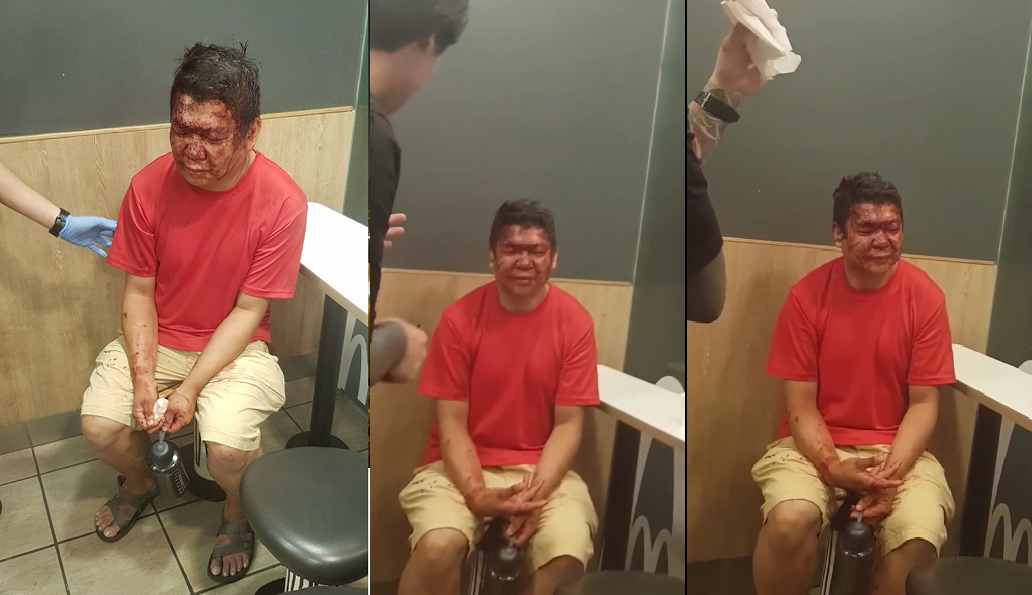 MAN ALLEGEDLY BEATEN UP AT TOA PAYOH MCDONALD’S BUT CLAIMS HE “FELL DOWN”
