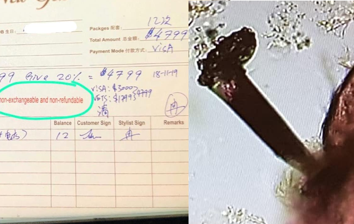 HAIR SALON SOLD $4799 PACKAGE TO TREAT ‘WORMS’ AND DIRTY SCAB AT YISHUN