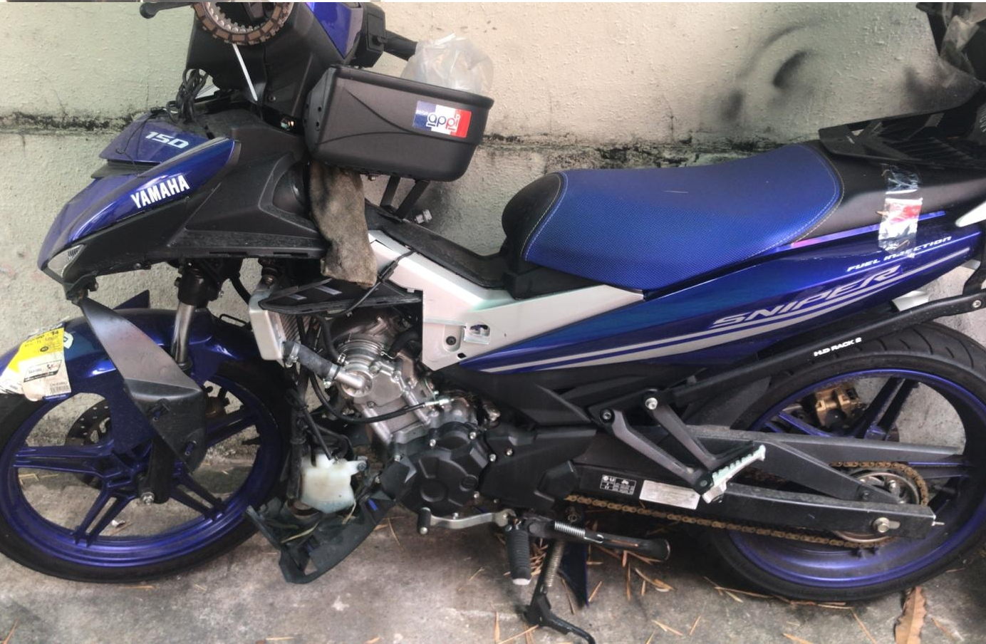 SMALL INTESTINE RUPTURED AFTER ACCIDENT AT HOUGANG