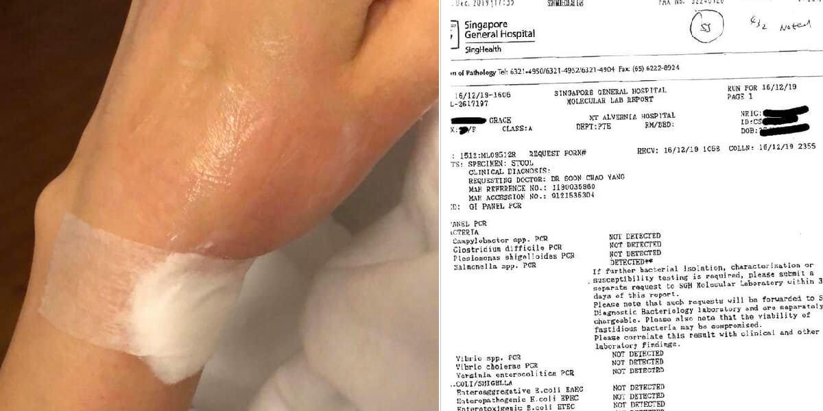 WOMAN CONTRACTS SALMONELLA AFTER EATING SUSHI AT CHANGI AIRPORT