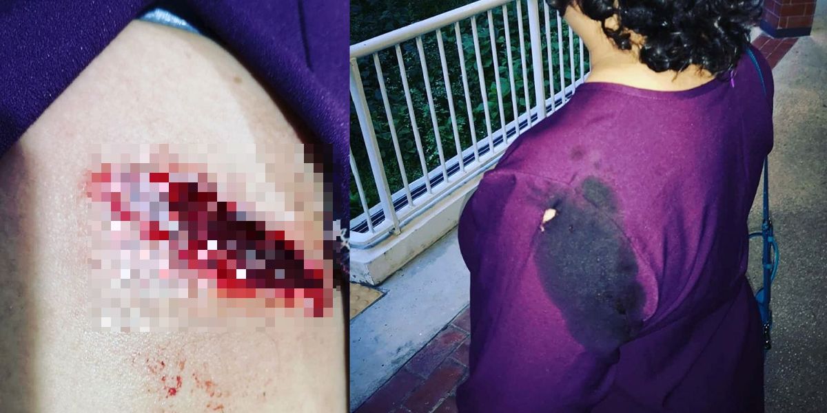 MOTORCYCLIST RECEIVED 12 STITCHES AFTER IRON PIPE FALLS FROM TRUCK