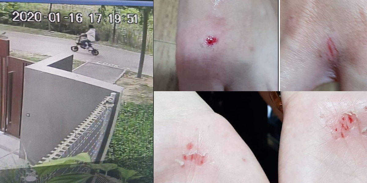 PMD HIT AND RUN AT PUNGGOL PARK.