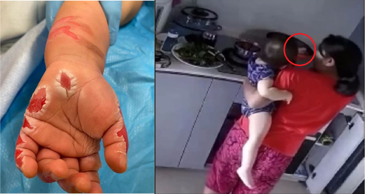 BLACK HEARTED MAID PUT BABY’S HAND INTO HOT POT TO ‘COOK’ AT BUANGKOK LINK