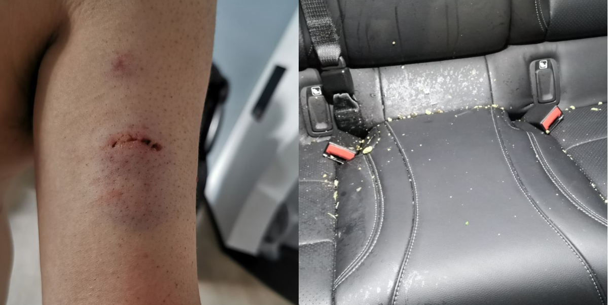 DRUNKARD VOMITTED IN TAXI, ATTACKS AND BITE DRIVER, STEALS CAR CAMERA AT JURONG
