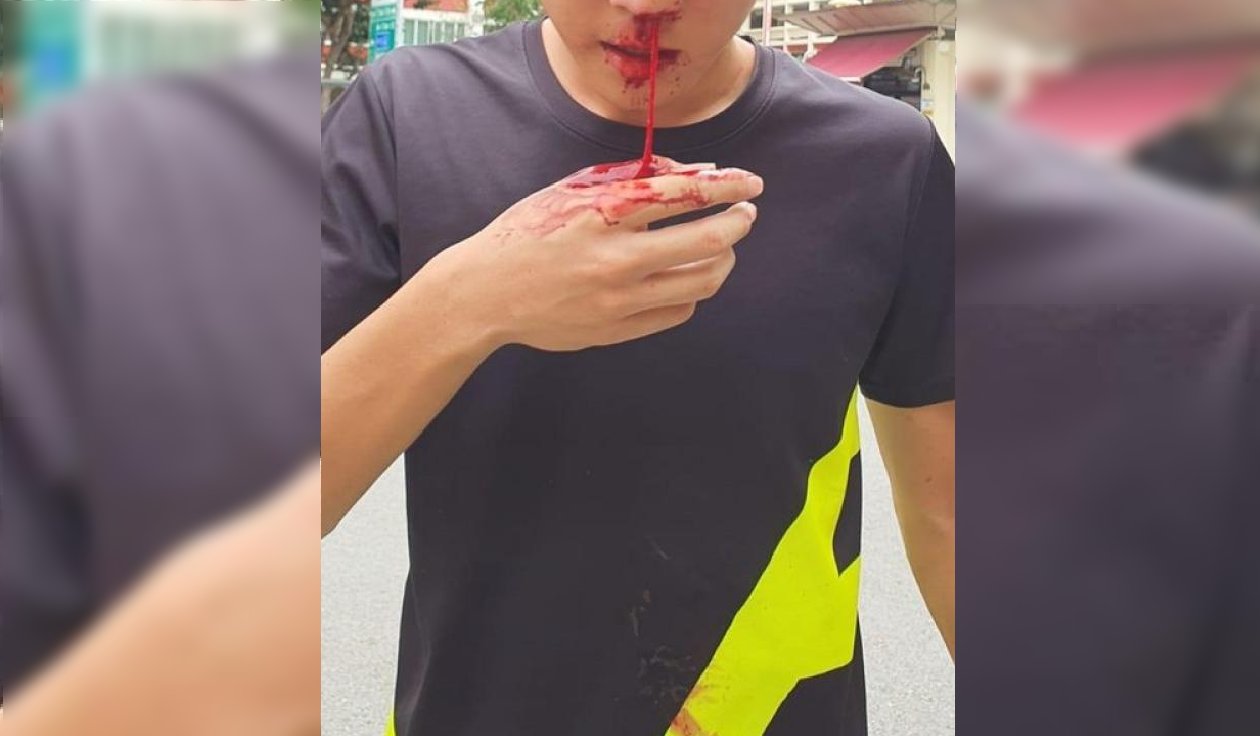 ITE STUDENT WENT TO SECONDARY SCHOOL AND ATTACK 17 YEAR OLD
