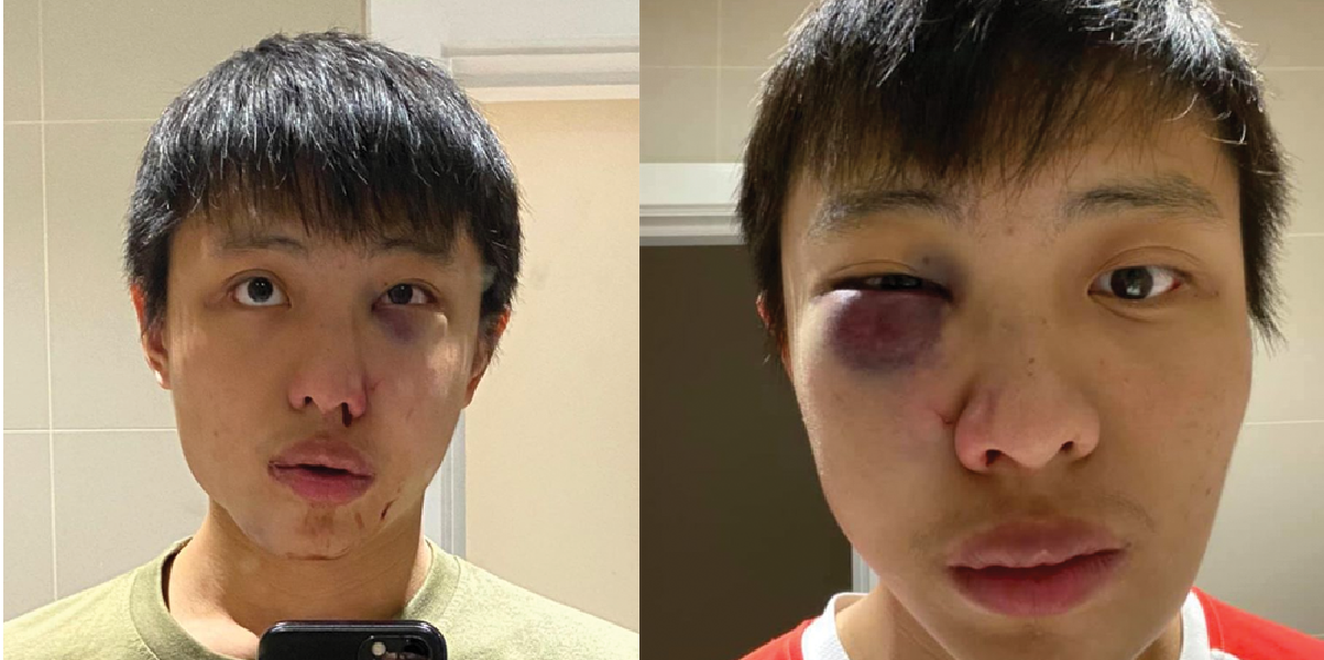 S’POREAN BEAT UP IN LONDON OVER FEAR OF CORONAVIRUS.