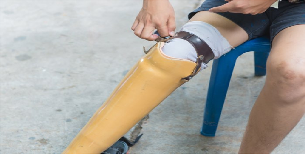 COVID-19 CAUSE BLOOD CLOTS WHICH LEADS TO STROKE AND AMPUTATION