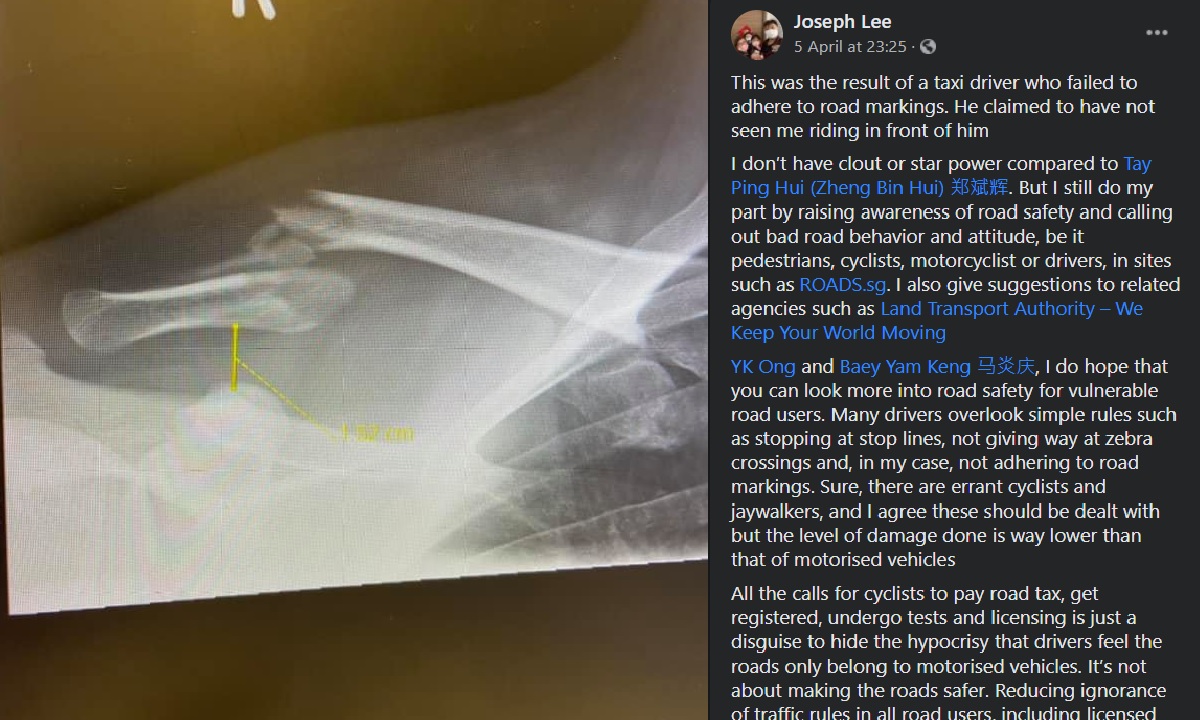 CYCLIST SUFFER FROM FRACTURED BONES AFTER GETTING BANG BY TAXI