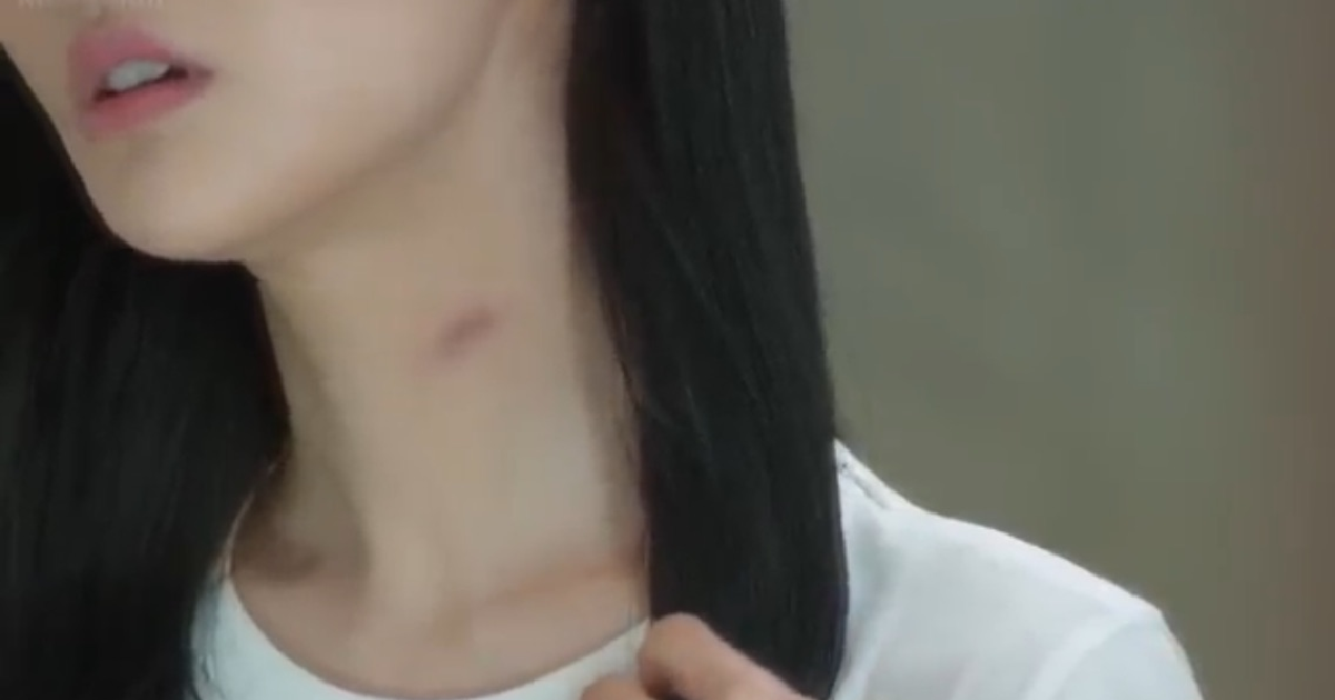 SG WIFE ASK FLING TO GIVE HER LOVEBITES. BACKS DOWN AFTER HUSBAND STOP GIVING MONEY