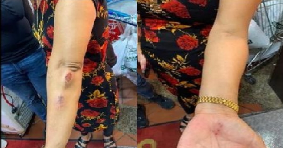 PM LEE HSIEN LOONG NOT HAPPY WITH RACIST ATTACK ON S’POREAN WOMAN